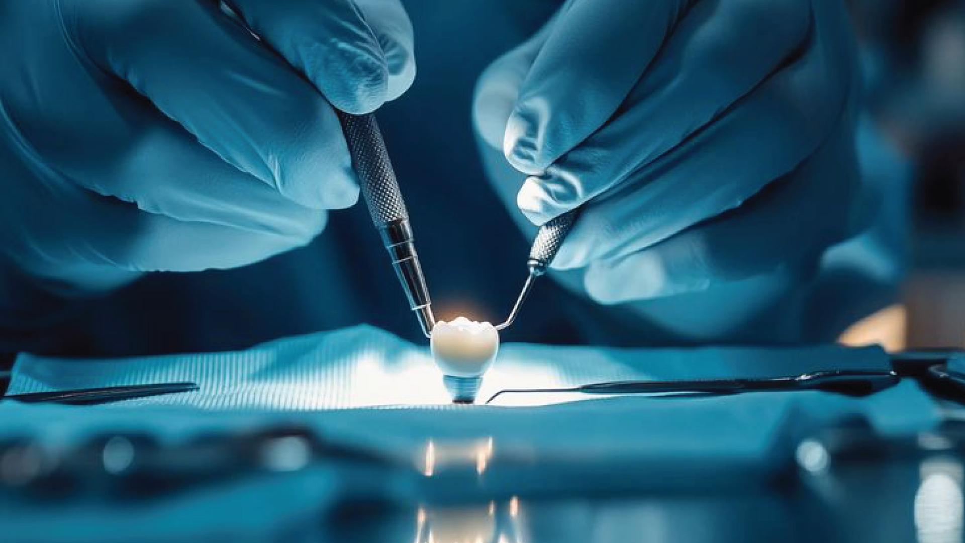 TRỒNG RĂNG IMPLANT – ABUTMENT LÀ GÌ VÀ TẠI SAO QUAN TRỌNG?