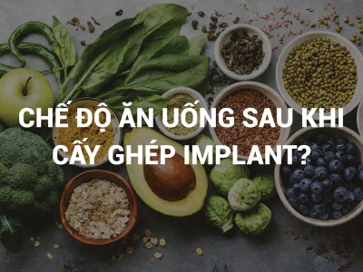 CHẾ ĐỘ ĂN UỐNG SAU KHI CẤY GHÉP IMPLANT
