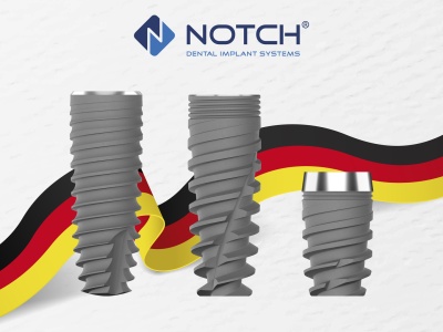 TRỤ IMPLANT TỒN TẠI ĐƯỢC BAO LÂU?